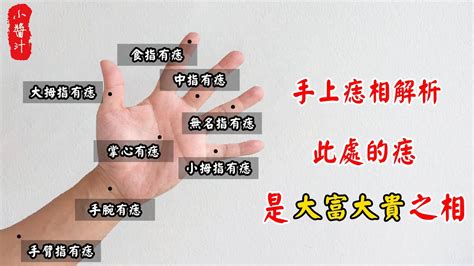 右手肘有痣|【手肘內有痣】揭秘手肘內有痣的玄機：前世緣分與好運交會